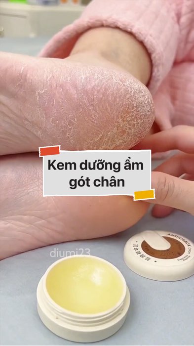 ￼Kem dưỡng ẩm gót chân, da tay #VideohangLamDep#shopeestyle#ShopeeVideo#ShopeeCreator #LuotVuiMuaLien#KOLUyTin#Videomuasam #SandealcungKOL #diumi969
